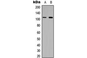 Western blot analysis of Collagen 6 alpha 1 expression in HeLa (A), H9C2 (B) whole cell lysates. (COL6A1 抗体  (Center))