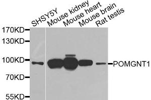Western blot analysis of extracts of various cell lines, using POMGNT1 antibody. (POMGNT1 抗体)