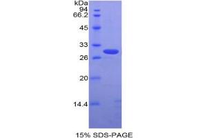 SDS-PAGE analysis of Rabbit ALCAM Protein.