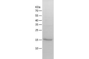 Western Blotting (WB) image for Acireductone Dioxygenase 1 (ADI1) (AA 1-179) protein (His tag) (ABIN7121650) (ADI1 Protein (AA 1-179) (His tag))