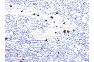 Formalin-fixed, paraffin-embedded human Tonsil stained with Cystatin A Mouse Monoclonal Antibody (CPTC-CSTA-1). (CSTA 抗体)