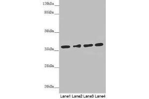 Western blot All lanes: ERLIN2 antibody at 3. (ERLIN2 抗体  (AA 212-339))