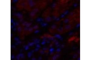 Immunofluorescence analysis of Human kidney tissue using IL8 Polyclonal Antibody at dilution of 1:200. (IL-8 抗体)