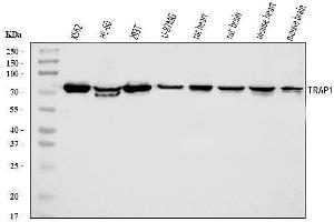 Western blot analysis of TRAP1 using anti-TRAP1 antibody (ABIN7602179).