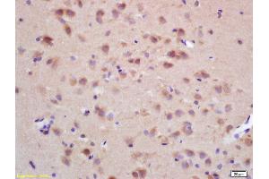 Formalin-fixed and paraffin embedded rat brain labeled with Rabbit Anti CHRNB2 Polyclonal Antibody, Unconjugated (ABIN705836) at 1:200 followed by conjugation to the secondary antibody and DAB staining (CHRNB1 抗体  (AA 131-230))