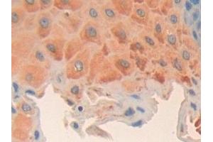 Detection of CCND2 in Human Esophagus Tissue using Polyclonal Antibody to Cyclin D2 (CCND2) (Cyclin D2 抗体  (AA 68-278))