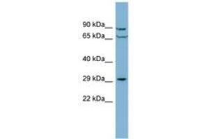 Image no. 1 for anti-CutC Copper Transporter Homolog (CUTC) (AA 179-228) antibody (ABIN6741896) (CUTC 抗体  (AA 179-228))