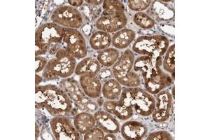 Immunohistochemical staining of human kidney with C6orf108 polyclonal antibody  shows strong cytoplasmic positivity in tubular cells. (RCL 抗体)