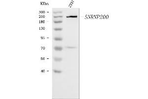 Western blot analysis of SNRNP200 using anti-SNRNP200 antibody (ABIN7602032). (SNRNP200 抗体  (AA 557-2129))