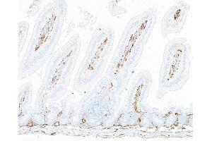 Immunohistochemistry (IHC) image for anti-Thrombomodulin (THBD) (AA 17-517) antibody (ABIN7795654)