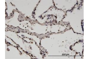 Immunoperoxidase of monoclonal antibody to ZNF192 on formalin-fixed paraffin-embedded human lung. (ZNF192 抗体  (AA 1-90))