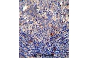 Immunohistochemistry (Paraffin-embedded Sections) (IHC (p)) image for anti-B-Cell CLL/lymphoma 10 (BCL10) (AA 24-51), (N-Term) antibody (ABIN654655)