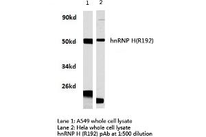 Western blot (WB) analysis of hnRNP H antibody in extracts from hela and A549 cells. (HNRNPH1 抗体)