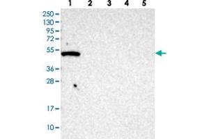 Western blot analysis of Lane 1: RT-4, Lane 2: U-251 MG, Lane 3: human plasma, Lane 4: liver, Lane 5: tonsil GTPBP10 polyclonal antibody . (GTPBP10 抗体)