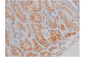 Immunohistochemistry (IHC) image for anti-Synuclein, alpha (SNCA) (pSer129) antibody (ABIN6254965)