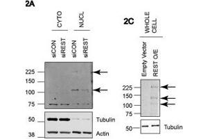 REST antibody - middle region  validated by WB using A549 and HEK293T cells at 1: 500. (REST 抗体  (Middle Region))