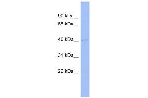 WB Suggested Anti-BTBD6 Antibody Titration:  0. (BTBD6 抗体  (Middle Region))