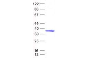 Western Blotting (WB) image for TGFB-Induced Factor Homeobox 1 (TGIF1) protein (His tag) (ABIN2733529)