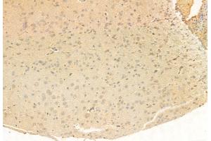 ABIN6265362 and ABIN6272951 at 1/100 staining Rat brain tissue by IHC-P.