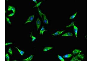 Immunofluorescent analysis of Hela cells using ABIN7165997 at dilution of 1:100 and Alexa Fluor 488-congugated AffiniPure Goat Anti-Rabbit IgG(H+L) (BBS9 抗体  (AA 8-185))