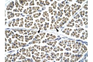 GABRD antibody was used for immunohistochemistry at a concentration of 4-8 ug/ml to stain Skeletal muscle cells (arrows) in Human Muscle. (GABRD 抗体  (N-Term))