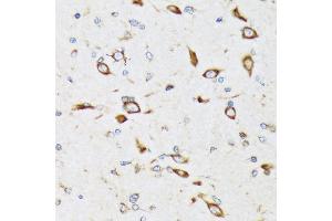 Immunohistochemistry of paraffin-embedded rat brain using RPS20 Rabbit mAb (ABIN7270017) at dilution of 1:100 (40x lens). (RPS20 抗体)