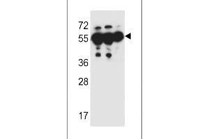 ANKRD57 Antibody (C-term) (ABIN651987 and ABIN2840483) western blot analysis in MDA-M,HepG2,A549 cell line lysates (35 μg/lane). (ANKRD57 抗体  (C-Term))