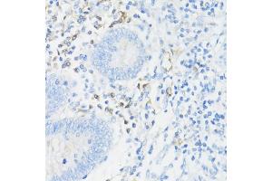 Immunohistochemistry of paraffin-embedded human appendix using CD11a/LFA-1A/ITGAL antibody (ABIN3015541, ABIN3015542, ABIN3015543, ABIN1680526 and ABIN6218728) at dilution of 1:100 (40x lens).