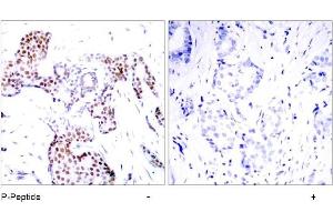 Image no. 1 for anti-ELK1, Member of ETS Oncogene Family (ELK1) (pSer389) antibody (ABIN196678) (ELK1 抗体  (pSer389))