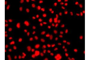 Immunofluorescence analysis of A549 cell using PRICKLE2 antibody. (PRICKLE2 抗体)