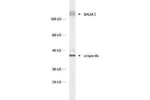 dilution: 1 : 1000, sample: synaptic membrane fraction of rat brain (LP1) (LRFN1 抗体)
