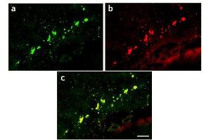 Image no. 1 for anti-Green Fluorescent Protein (GFP) antibody (ABIN346938) (GFP 抗体)