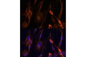 Immunofluorescence analysis of C6 cells using BFAR Polyclonal Antibody (ABIN6127492, ABIN6137542, ABIN6137543 and ABIN6224322) at dilution of 1:100 (40x lens). (BFAR 抗体  (AA 1-140))