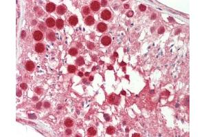 Immunohistochemistry (Paraffin-embedded Sections) (IHC (p)) image for anti-Zinc Finger, MYM-Type 2 (ZMYM2) (AA 1327-1377) antibody (ABIN2630002)