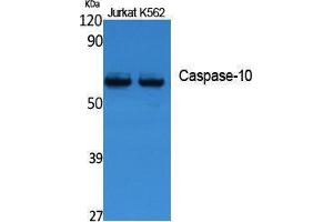 Western Blotting (WB) image for anti-Caspase 10, Apoptosis-Related Cysteine Peptidase (CASP10) (Internal Region) antibody (ABIN3187650) (Caspase 10 抗体  (Internal Region))