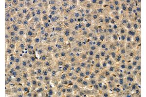 ABIN6257996 and ABIN6275136 at 1/100 staining Rat liver tissue by IHC-P. (FUT3 抗体  (Internal Region))