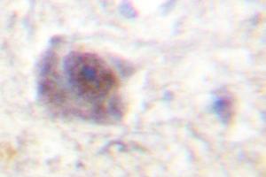 Image no. 1 for anti-Adenomatous Polyposis Coli (APC) antibody (ABIN271993) (APC 抗体)