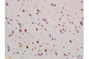Formalin-fixed and paraffin embedded: rat brain tissue labeled with Anti-Nogo-R Polyclonal Antibody , Unconjugated at 1:200 followed by conjugation to the secondary antibody and DAB staining (RTN4R 抗体  (AA 151-350))
