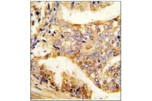Image no. 1 for anti-Pumilio Homolog 2 (Drosophila) (PUM2) (Ser182) antibody (ABIN360017) (PUM2 抗体  (Ser182))
