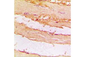 Immunohistochemical analysis of CKMT2 staining in human muscle formalin fixed paraffin embedded tissue section. (CKMT2 抗体  (Center))