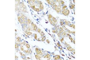 Immunohistochemistry of paraffin-embedded human stomach using DARS2 antibody. (DARS2 抗体  (AA 406-645))