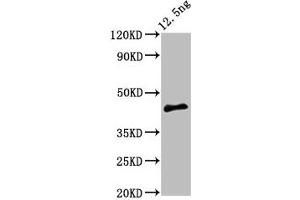 Western Blot Positive WB detected in Recombinant protein All lanes: PMRT15 antibody at 5 μg/mL Secondary Goat polyclonal to rabbit IgG at 1/50000 dilution Predicted band size: 44 kDa Observed band size: 44 kDa (PMRT15 抗体  (AA 513-637))