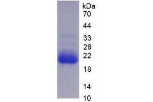 SDS-PAGE analysis of Human CYP3A7 Protein. (CYP3A7 蛋白)