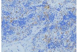 ABIN6273682 at 1/100 staining Human lymph node tissue by IHC-P. (Keratin 36 抗体  (Internal Region))