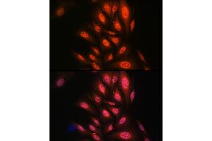 Immunofluorescence analysis of U2OS cells using P antibody (ABIN7269146) at dilution of 1:100.