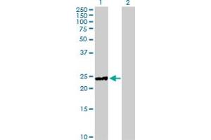 Western Blot analysis of HYAL1 expression in transfected 293T cell line by HYAL1 MaxPab polyclonal antibody. (HYAL1 抗体  (AA 1-253))