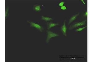 Immunofluorescence of purified MaxPab antibody to CCNT1 on HeLa cell. (Cyclin T1 抗体  (AA 1-726))