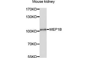 Western blot analysis of extracts of mouse kidney cells, using MEP1B antibody. (Meprin B 抗体)