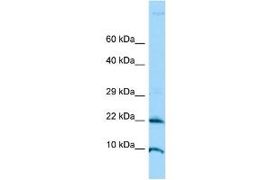 WB Suggested Anti-ADAT2 Antibody Titration: 1. (ADAT2 抗体  (N-Term))