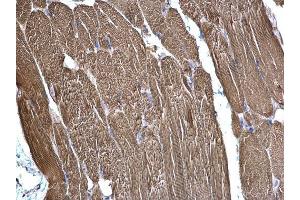 Immunohistochemistry (IHC) image for anti-Succinate Dehydrogenase Complex, Subunit B, Iron Sulfur (Ip) (SDHB) (C-Term) antibody (ABIN2855873)